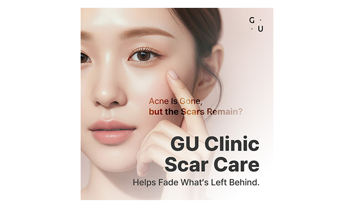Acne Scar Treatment: What to Know Before Choosing