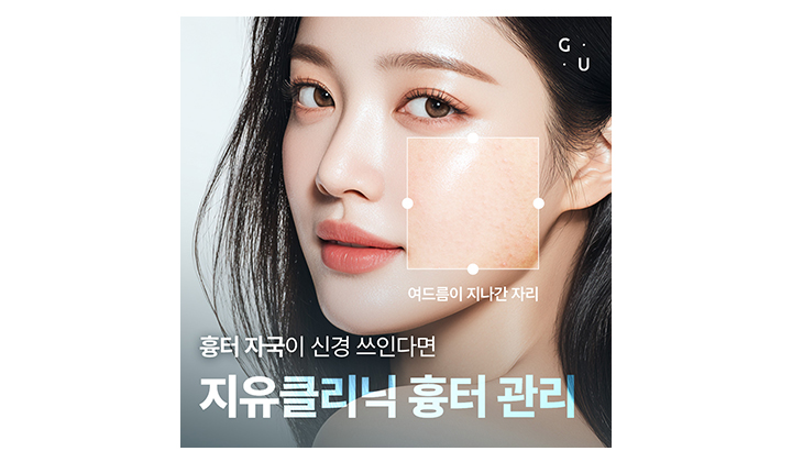피부흉터치료 쥬브젠, 비용보다 중요한 맞춤형 접근