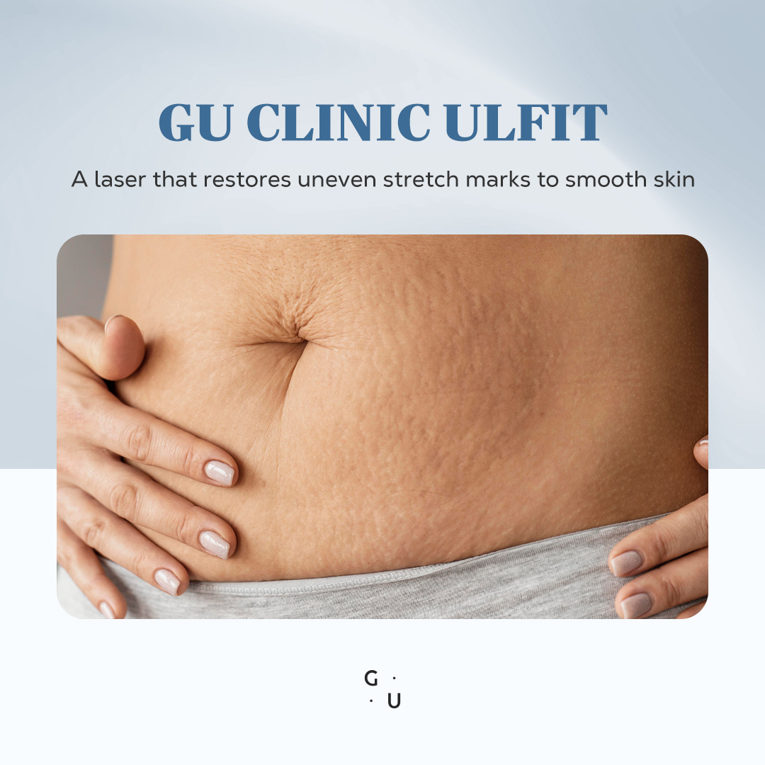 ghk-cu stretch marks Say Goodbye to Stretch Marks with GHK-Cu – Entera Skincare