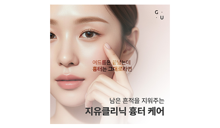 여드름 흉터 제거 방법, 시술 선택하기 전 알아둬야 할 부분
